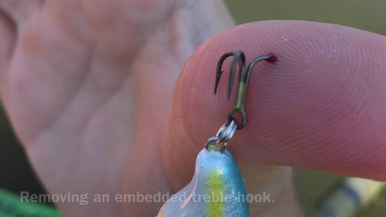 The Case for Single Hook Plugs - These new hooks are less painful